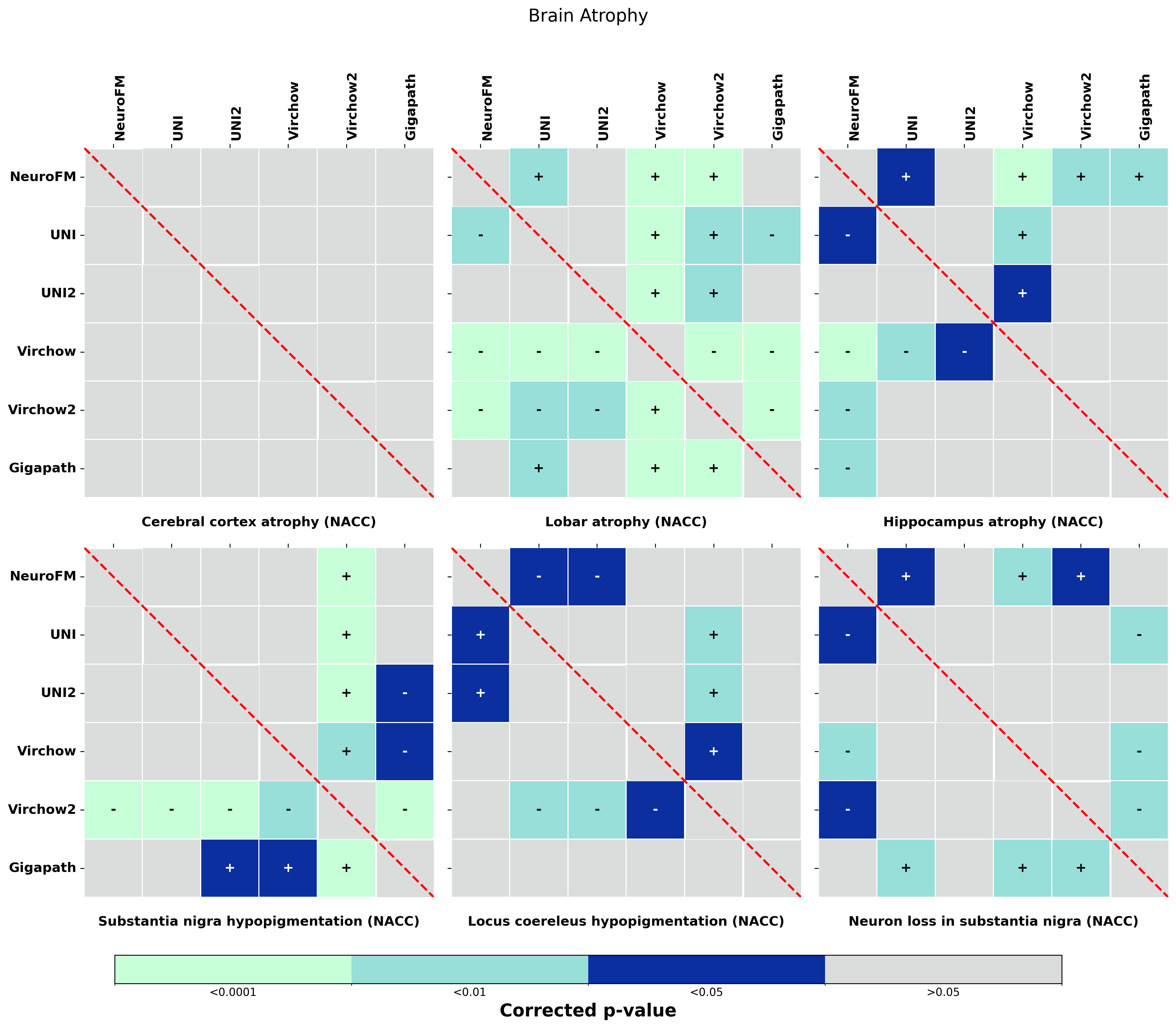 Statistical_heatmaps_with_colorbar_Brain_Atrophy.png
