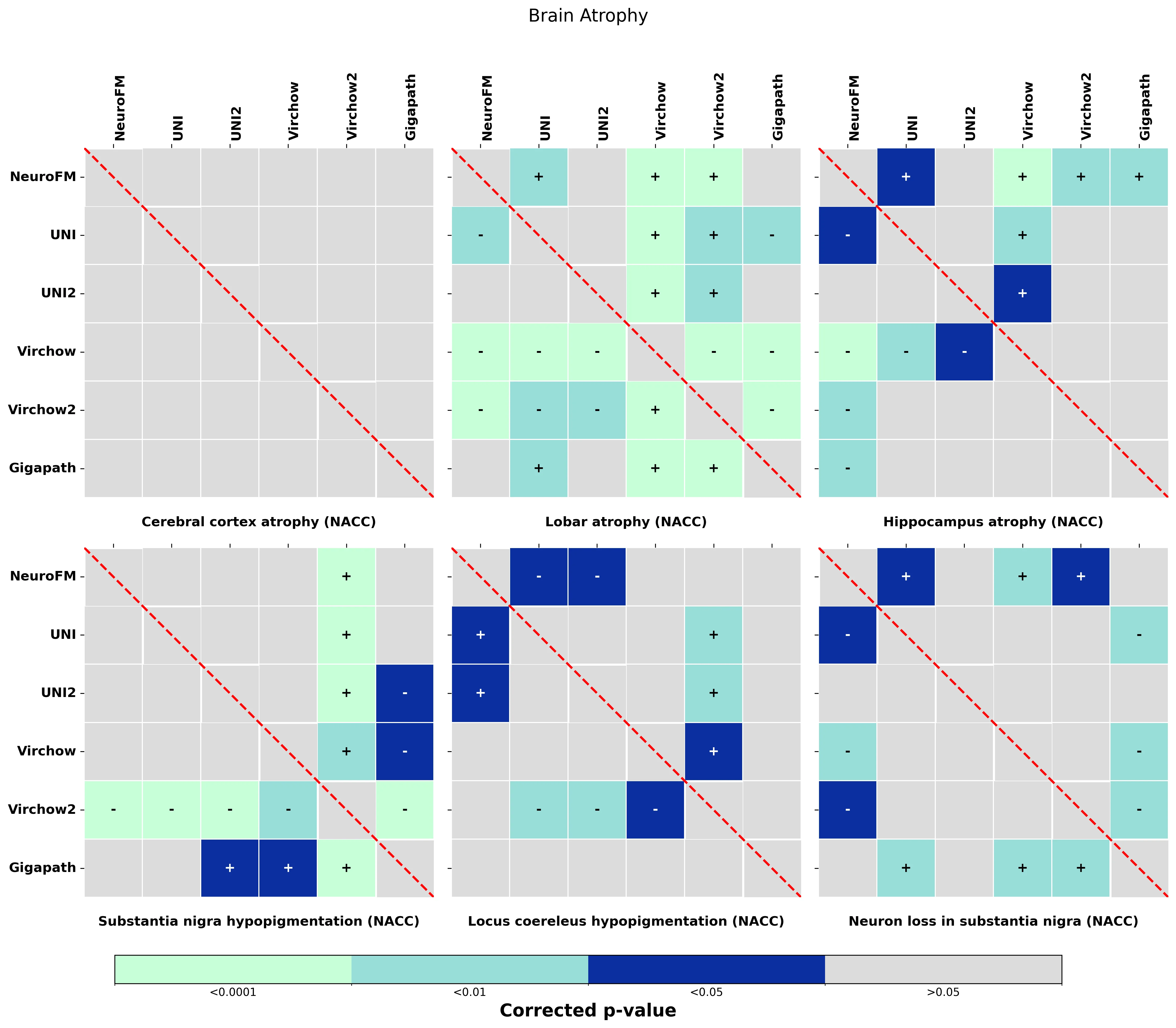 Statistical_heatmaps_with_colorbar_Brain_Atrophy.webp