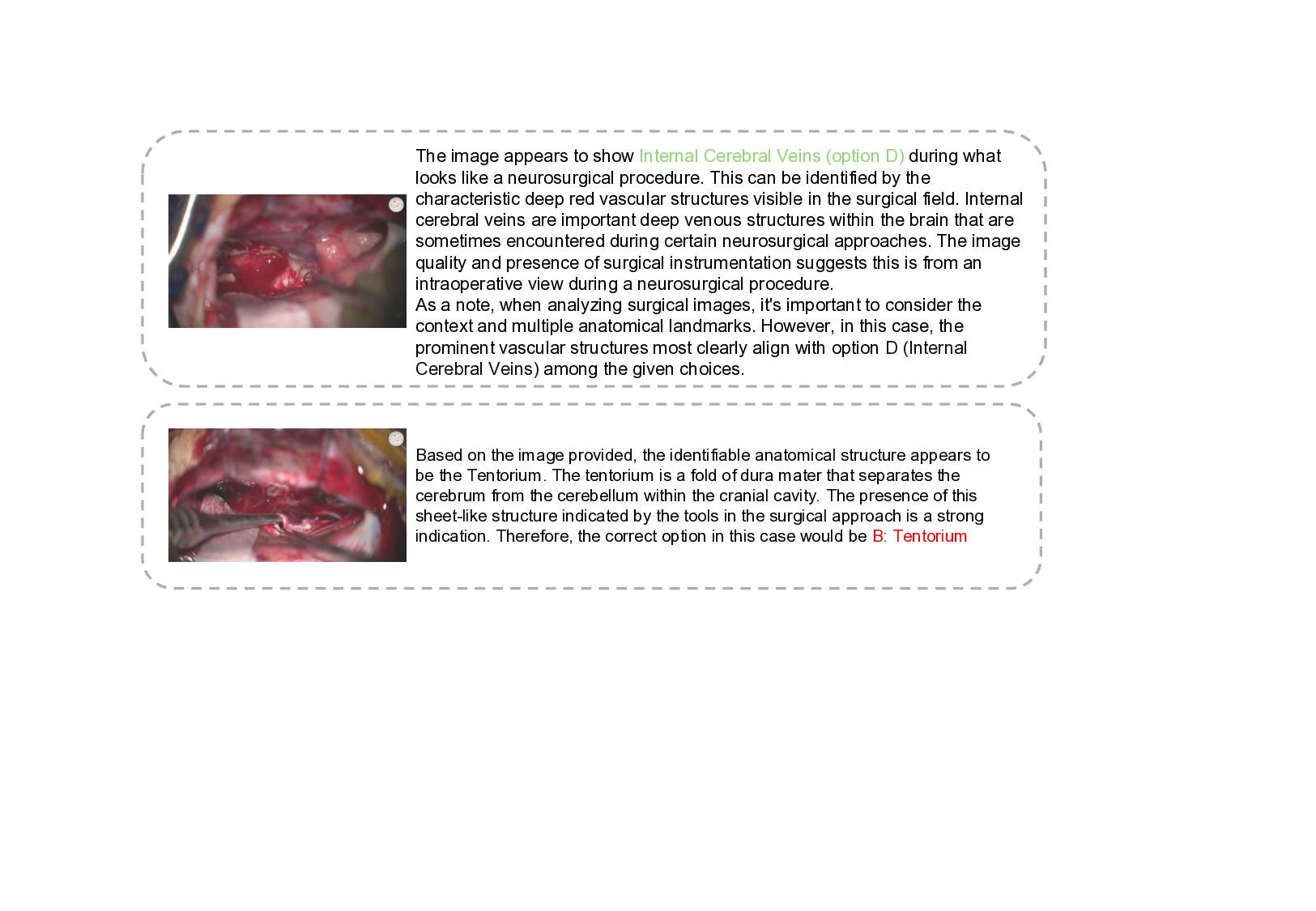 NeuroABench: A Multimodal Evaluation Benchmark for Neurosurgical Anatomy Identification