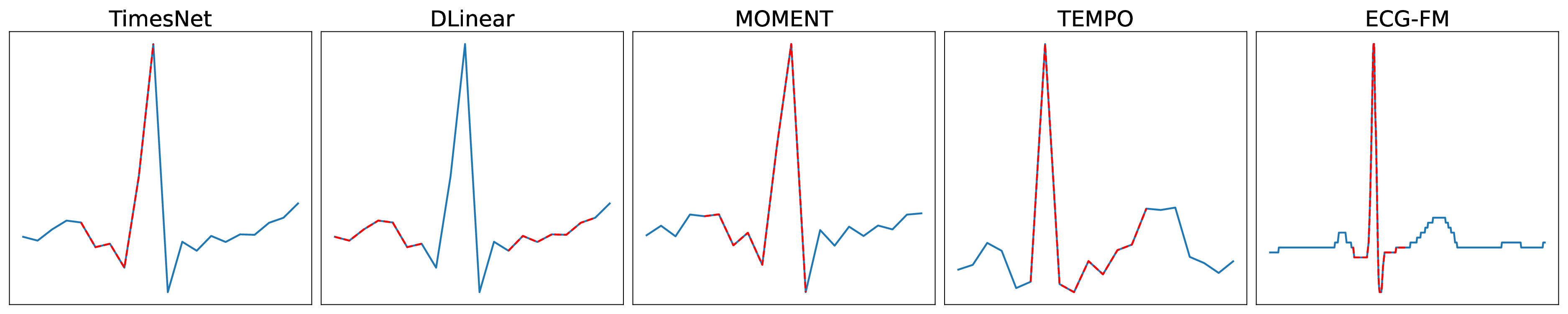 An Electrocardiogram Multi-task Benchmark with Comprehensive Evaluations and Insightful Findings