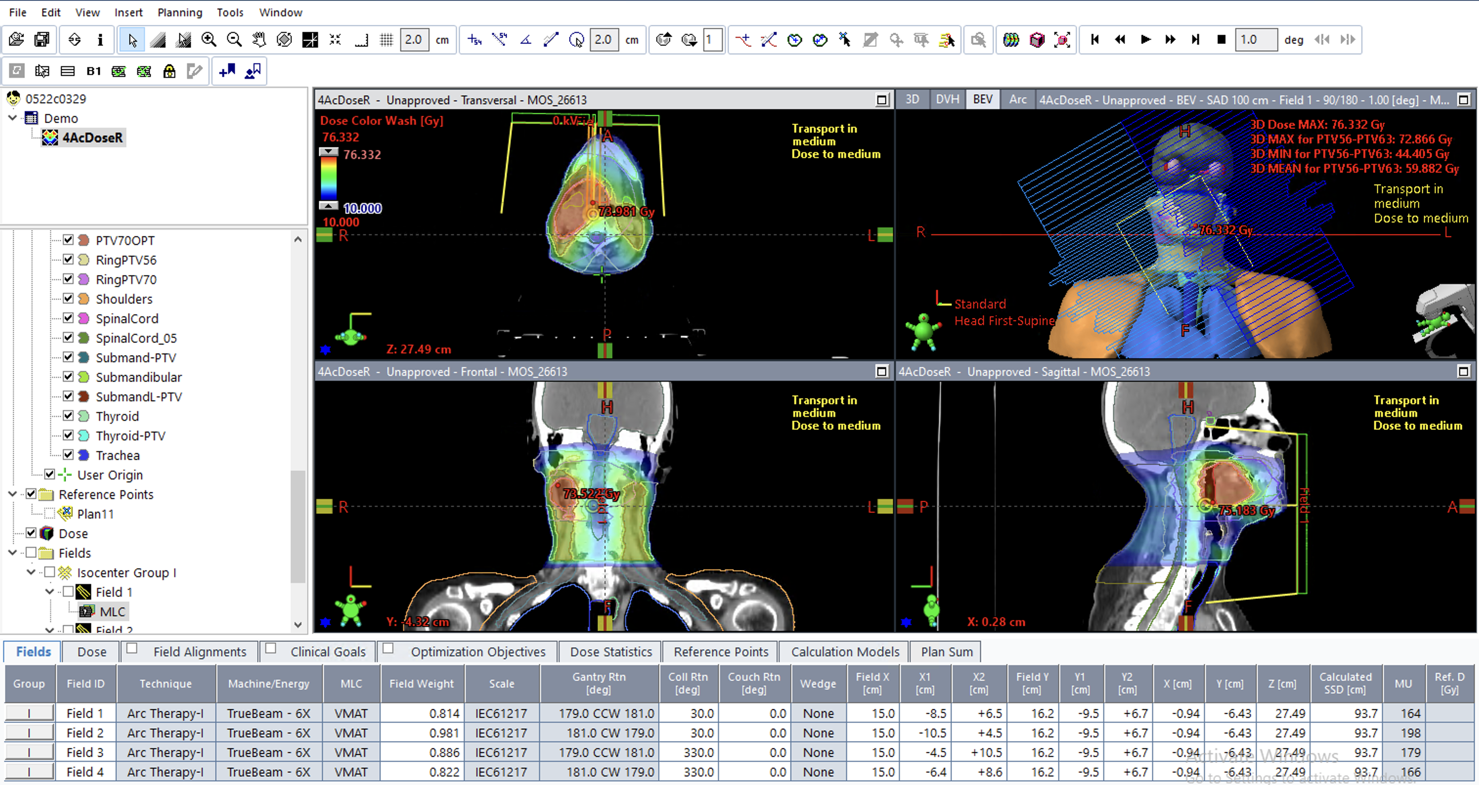 Demo: Generative AI helps Radiotherapy Planning with User Preference