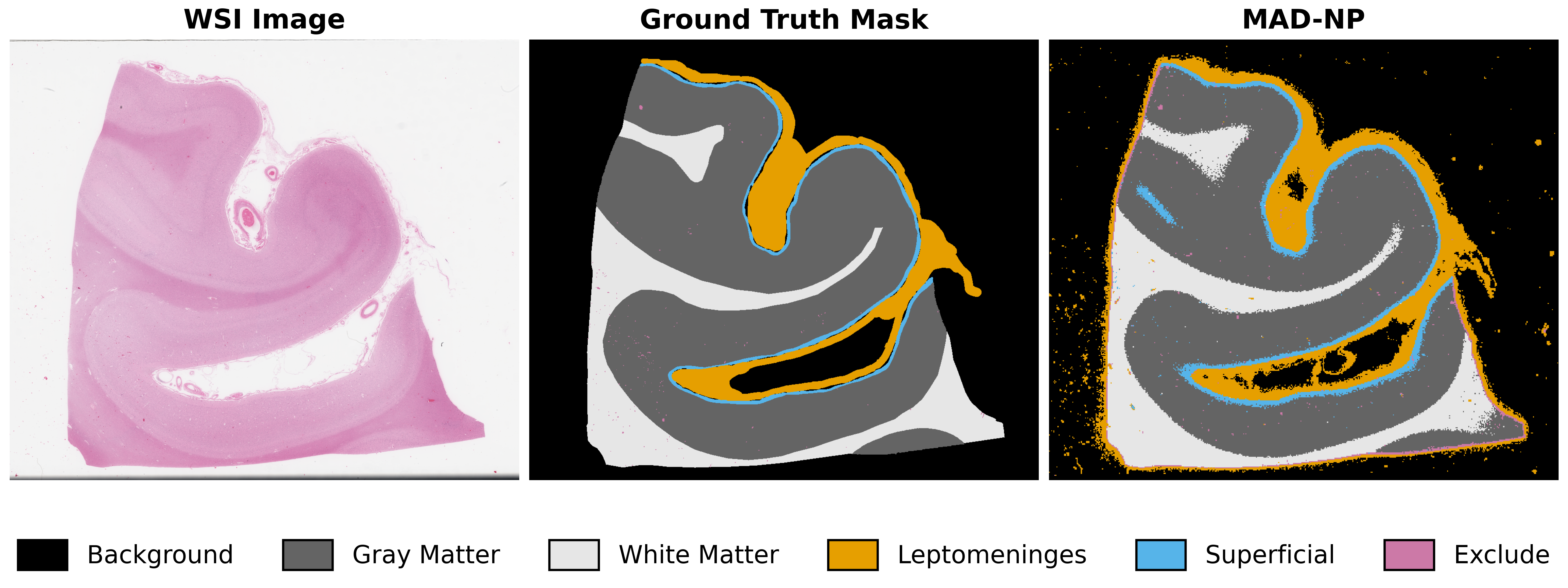 segmentation_comparison_40x_single_row.png