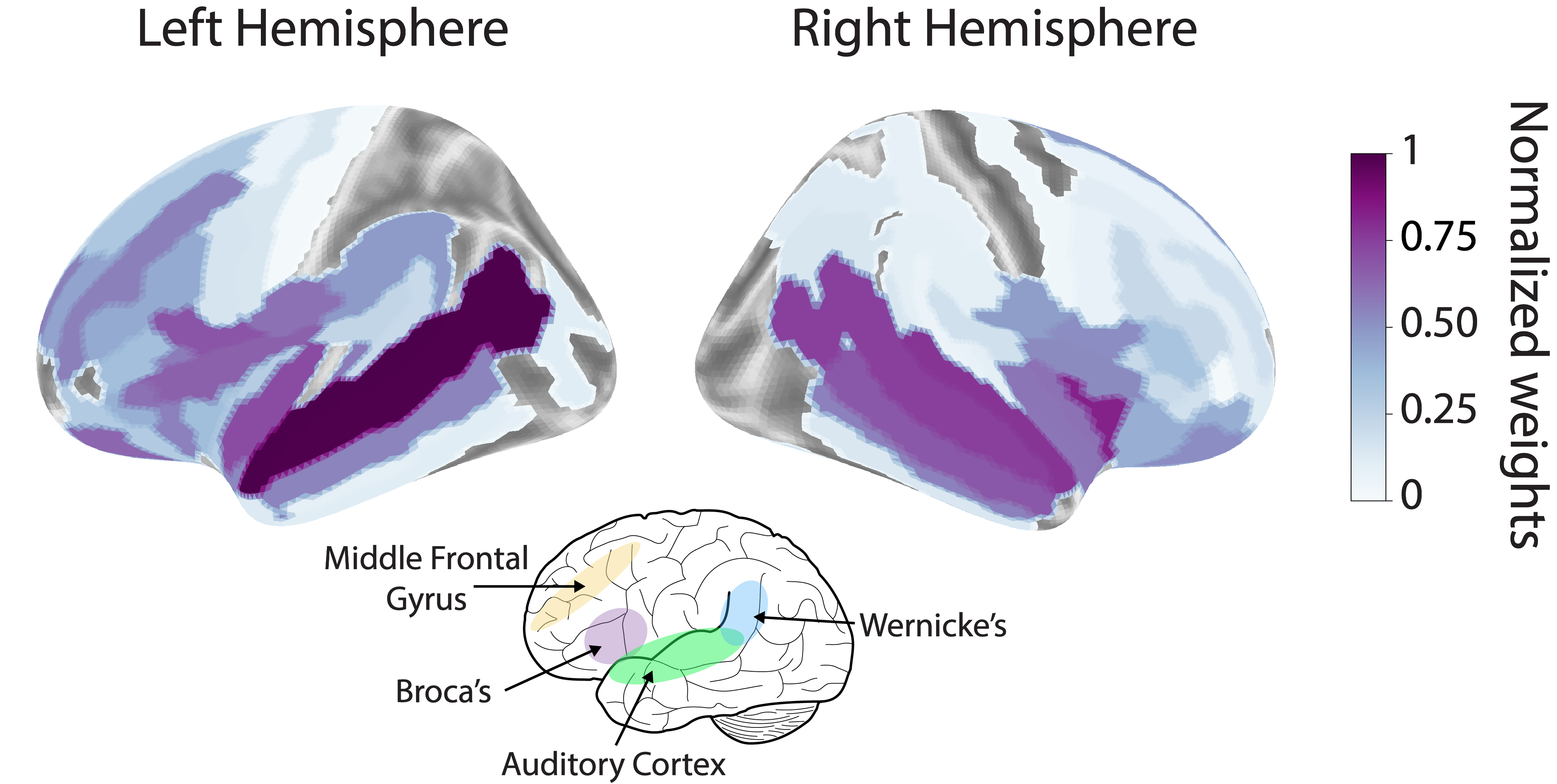 뇌 네트워크 패턴 학습을 위한 다중 영역 iEEG 변환기와 공간 스케일 가변 자기지도 학습