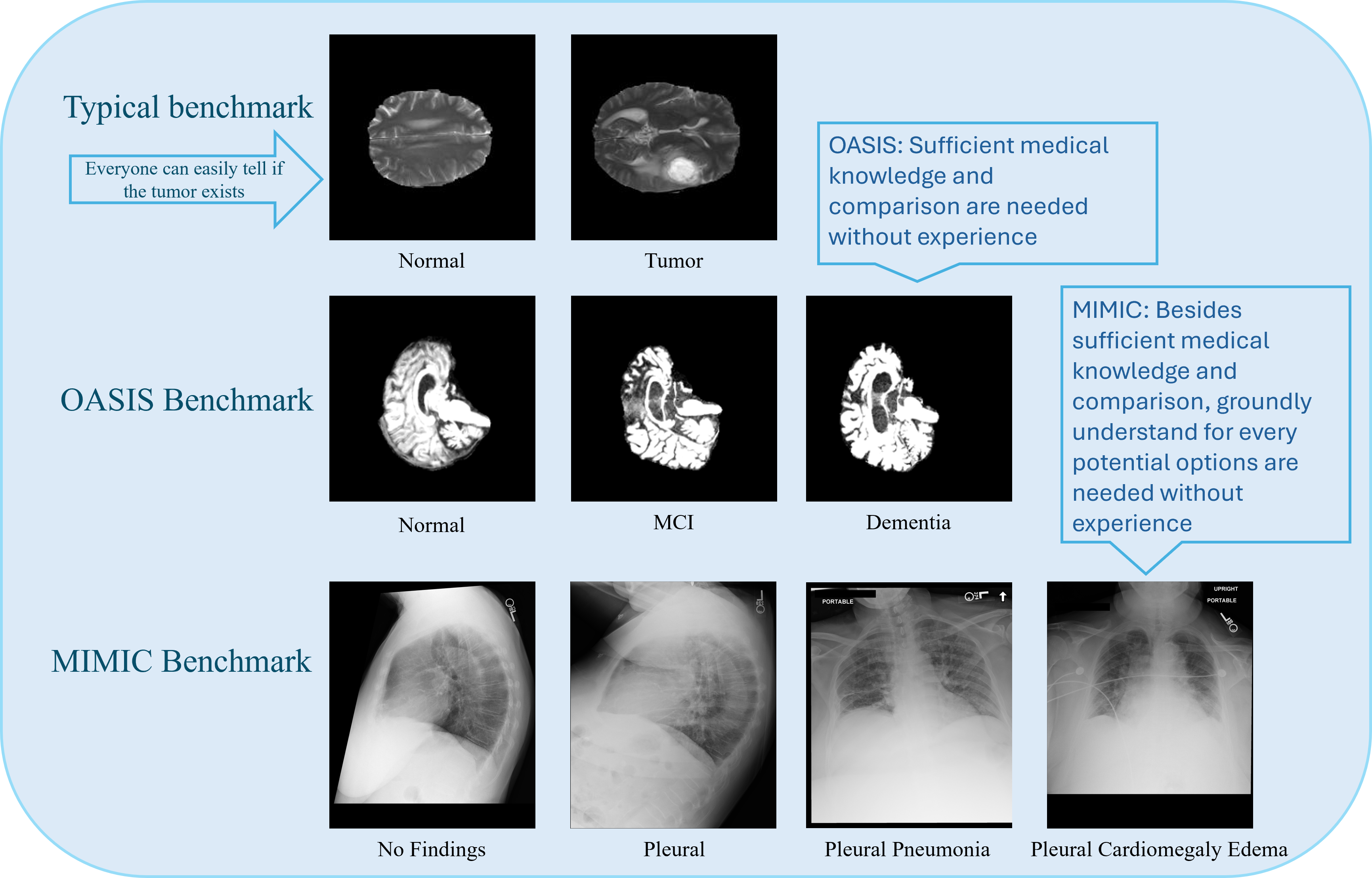 Why Text Prevails: Vision May Undermine Multimodal Medical Decision Making
