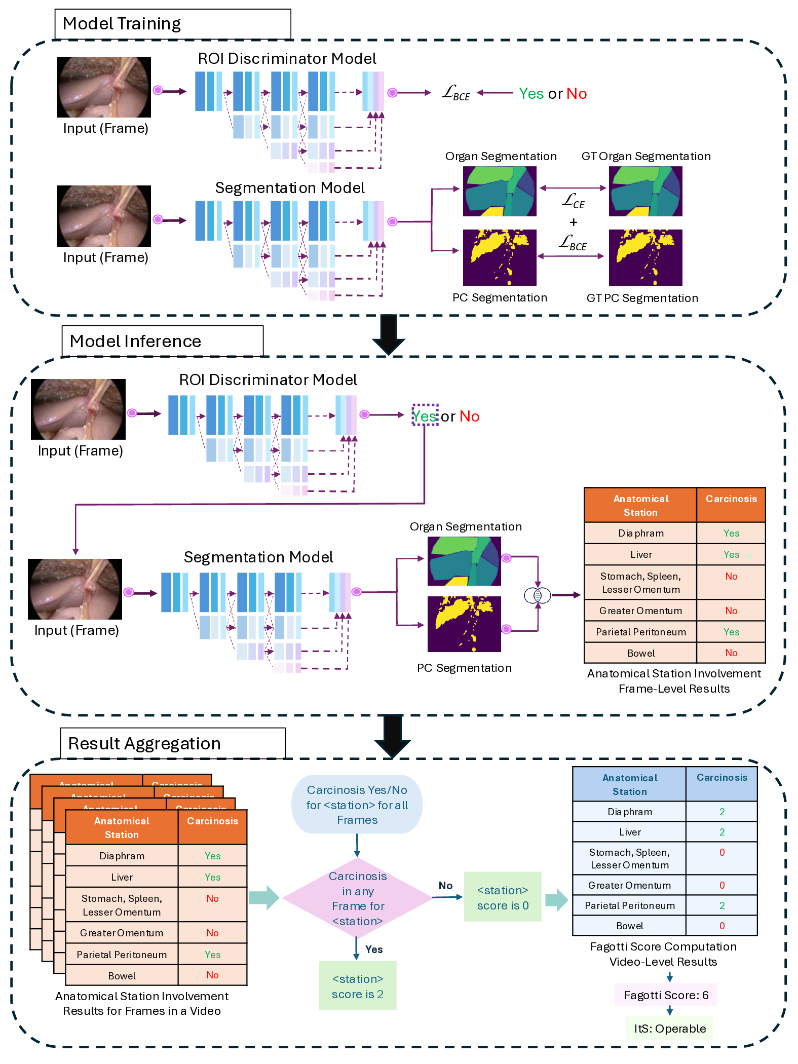 Artificial Intelligence for the Assessment of Peritoneal Carcinosis during Diagnostic Laparoscopy for Advanced Ovarian Cancer