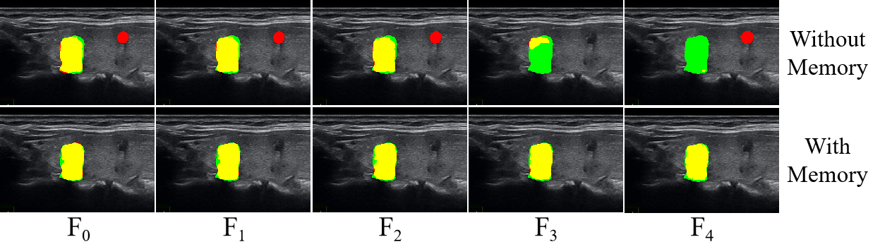 Tracking spatial temporal details in ultrasound long video via wavelet analysis and memory bank