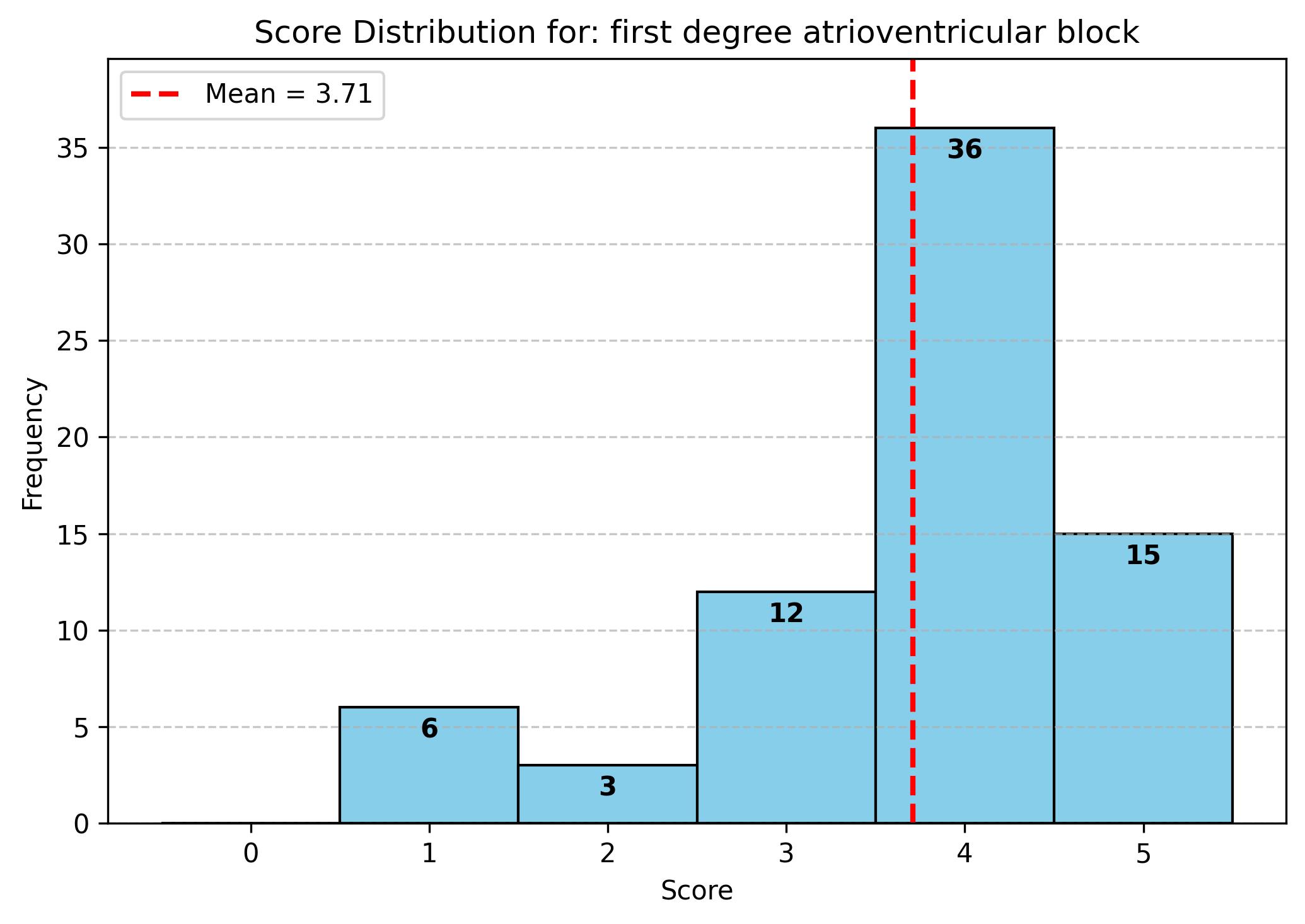 first_degree_atrioventricular_blockplot_output.jpg