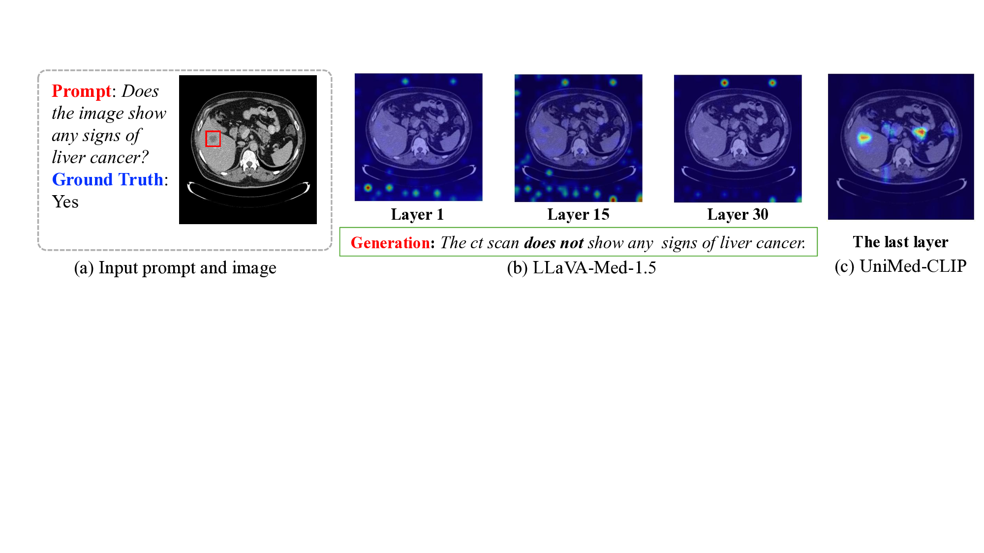 의료 비전 언어 모델 시각 정렬을 위한 경량 디스틸레이션