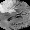 brats_8_mri.png