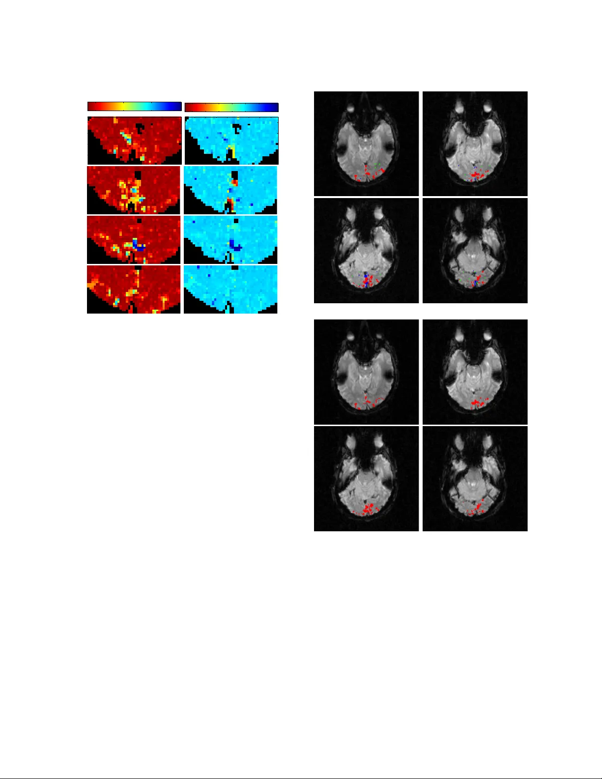 Low Dimensional Embedding of fMRI datasets