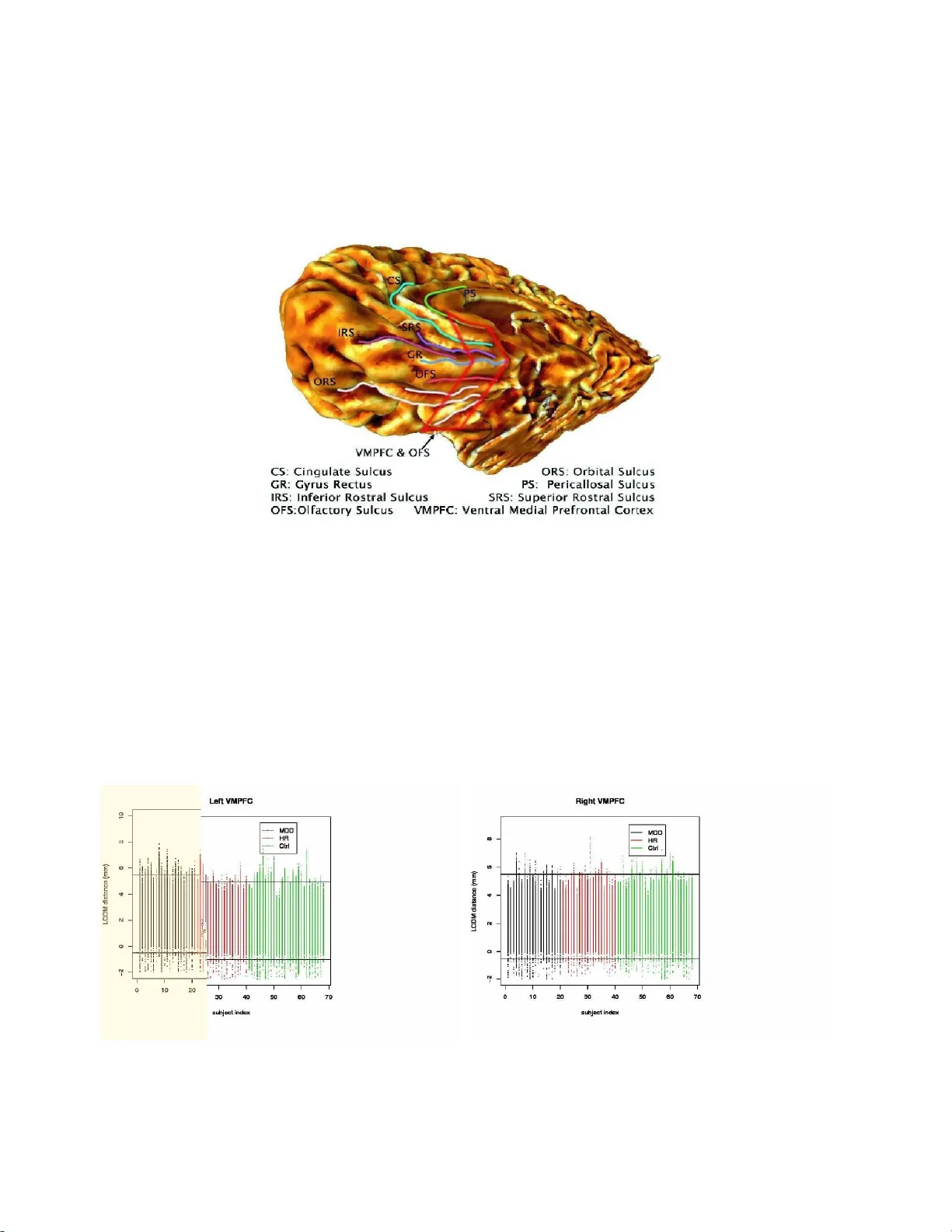 The Use of Labeled Cortical Distance Maps for Quantization and Analysis   of Anatomical Morphometry of Brain Tissues