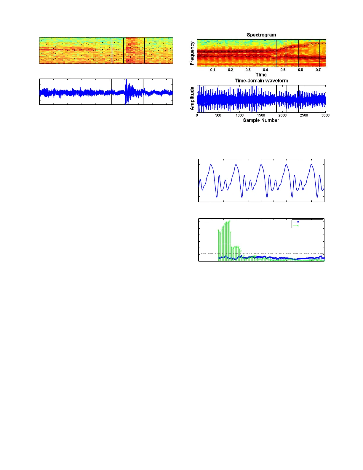시간변화 자기회귀 모델을 이용한 음성 분석 및 검출 이론