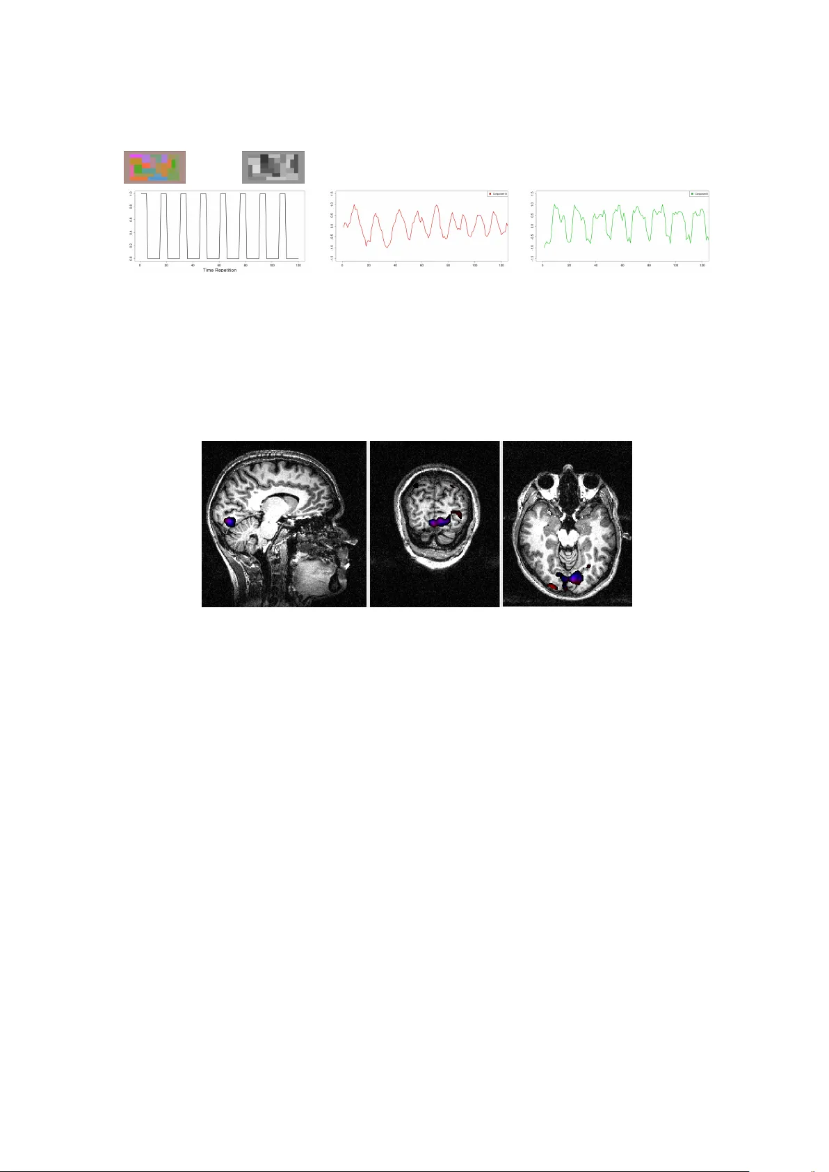 fMRI 데이터 분석을 위한 시공간 ICA와 R 패키지 구현