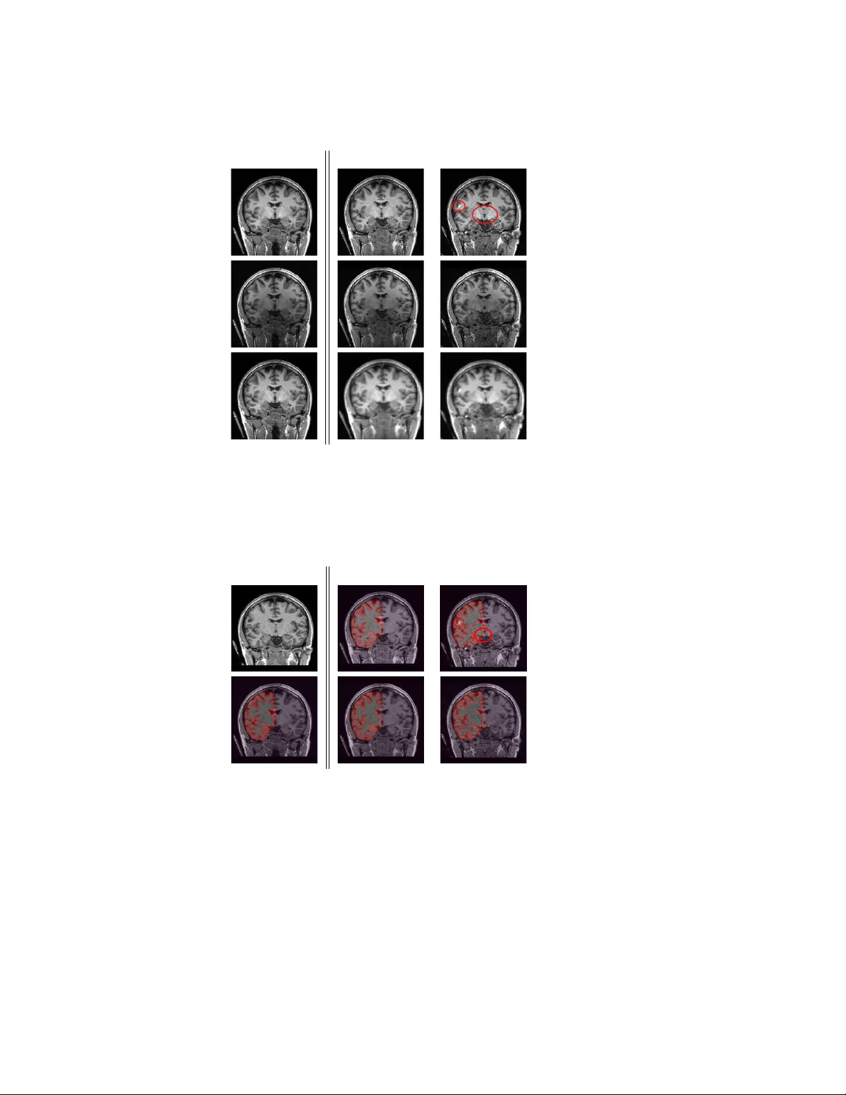 3D·4D 파라렐 MRI 재구성을 위한 시공간 웨이블릿 정규화