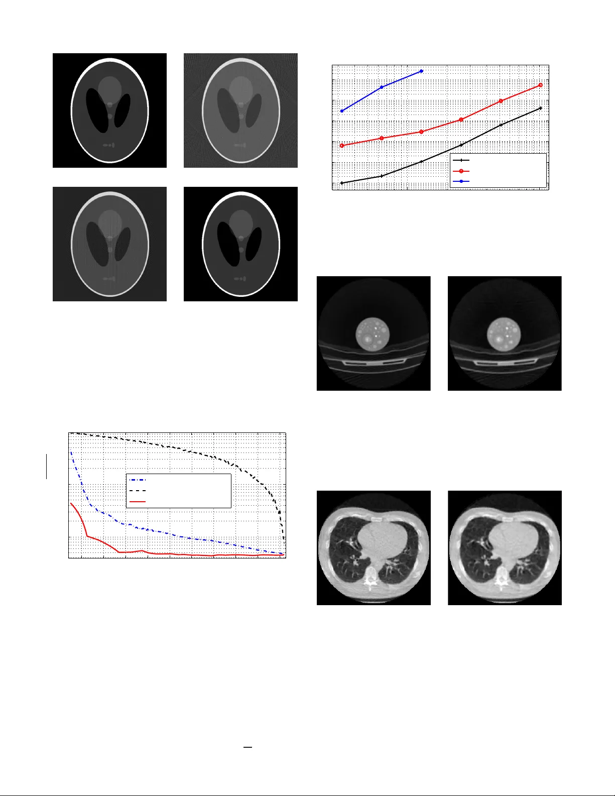 초저선량 Xray CT 재구성을 위한 가중 MAP 기반 압축센싱
