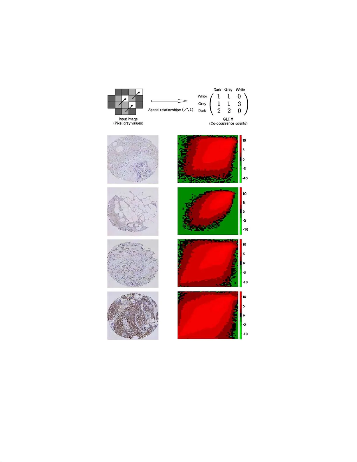 조직 배열 이미지 통계 분석: 알고리즘 점수 매기기와 공동 학습