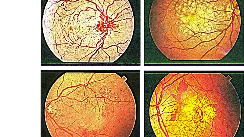 GIMP and Wavelets for Medical Image Processing: Enhancing Images of the   Fundus of the Eye