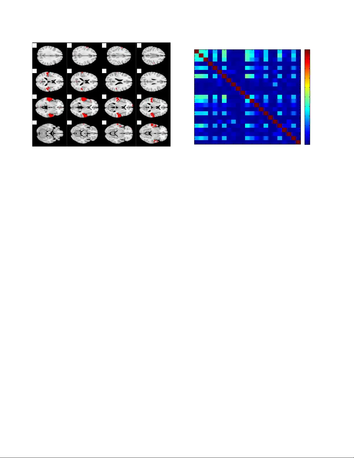 Diffusion map for clustering fMRI spatial maps extracted by independent   component analysis