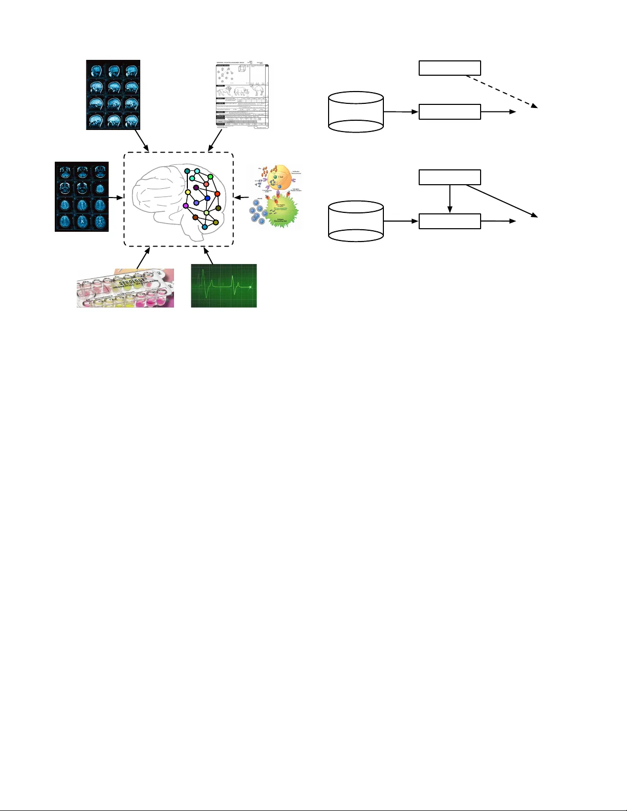 Mining Brain Networks using Multiple Side Views for Neurological   Disorder Identification