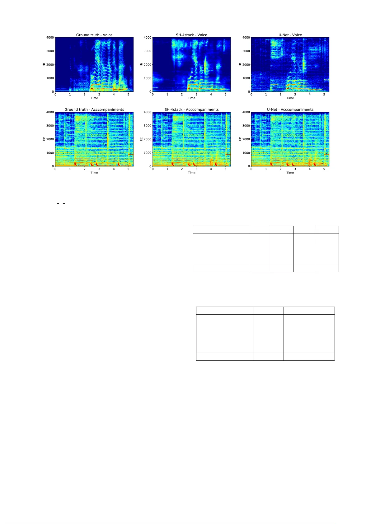 스택드 아워글래스 네트워크를 활용한 음악 소스 분리