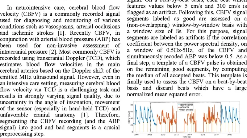 뇌혈류 속도 기록 자동 구분 알고리즘