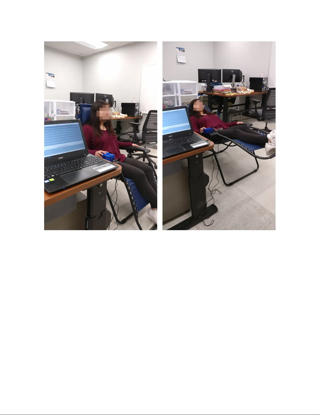 NIRS Based Bladder Volume Sensing for Patients Suffering with Neurogenic   Bladder Dysfunction