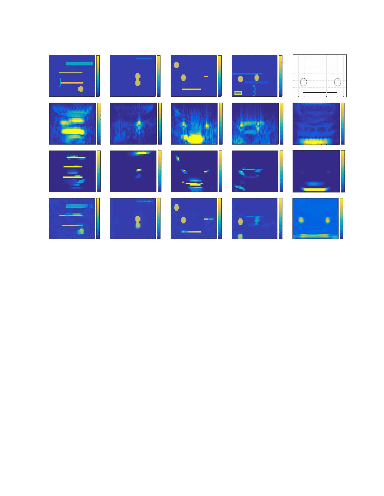 딥러닝 기반 비선형 초음파 재구성 혁신