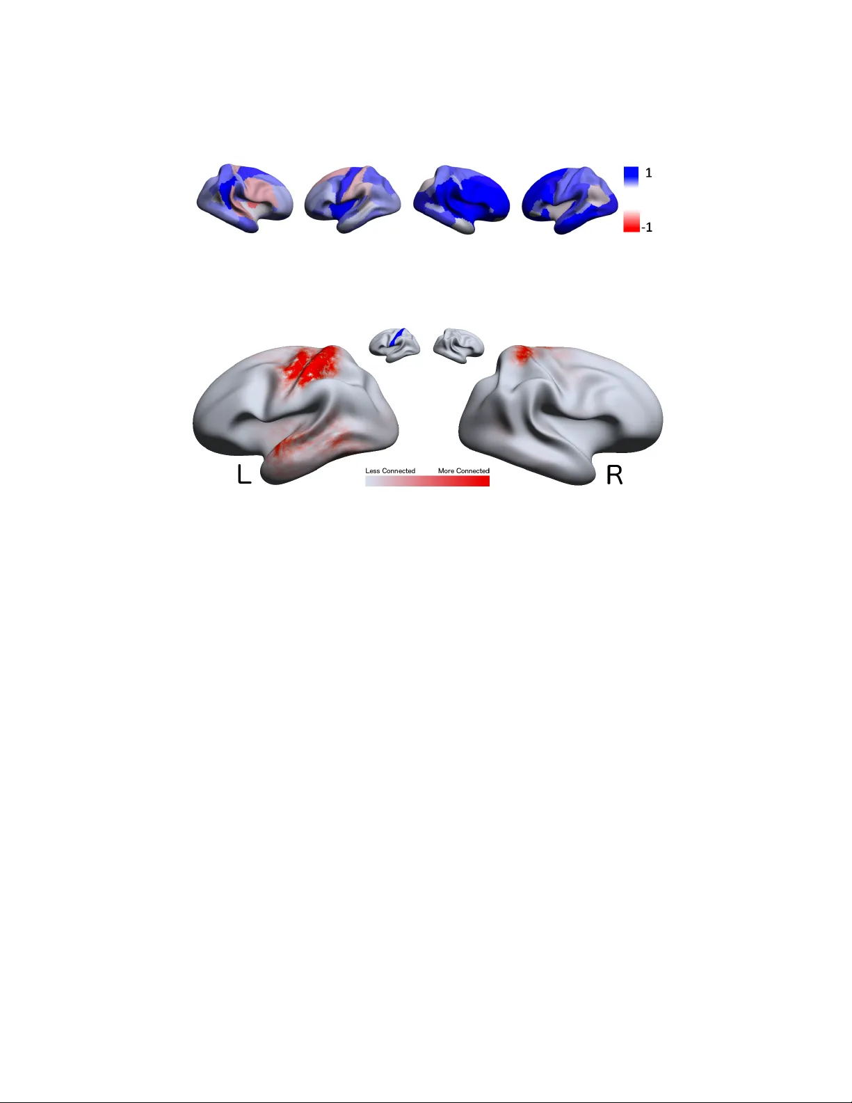 연속적 피질 연결성 모델