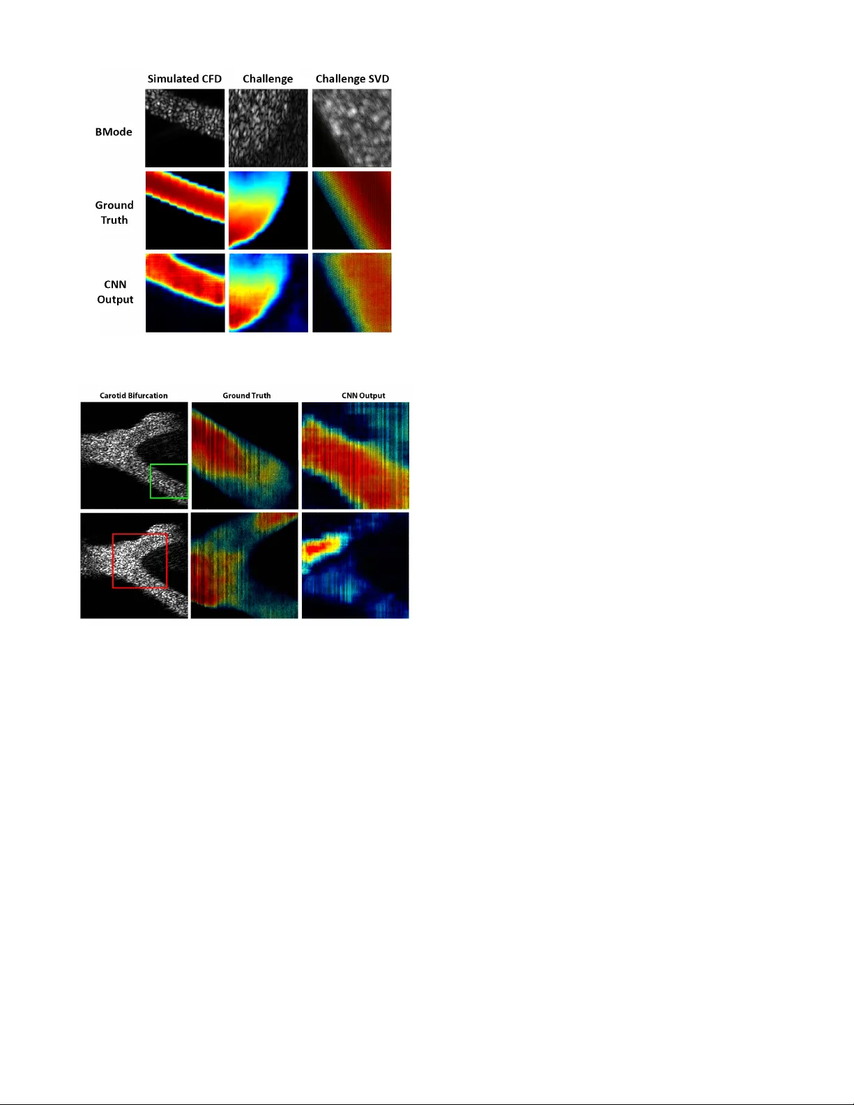 합성 개구 레이더 초음파를 이용한 벡터 흐름 영상, CNN으로 실시간 추정