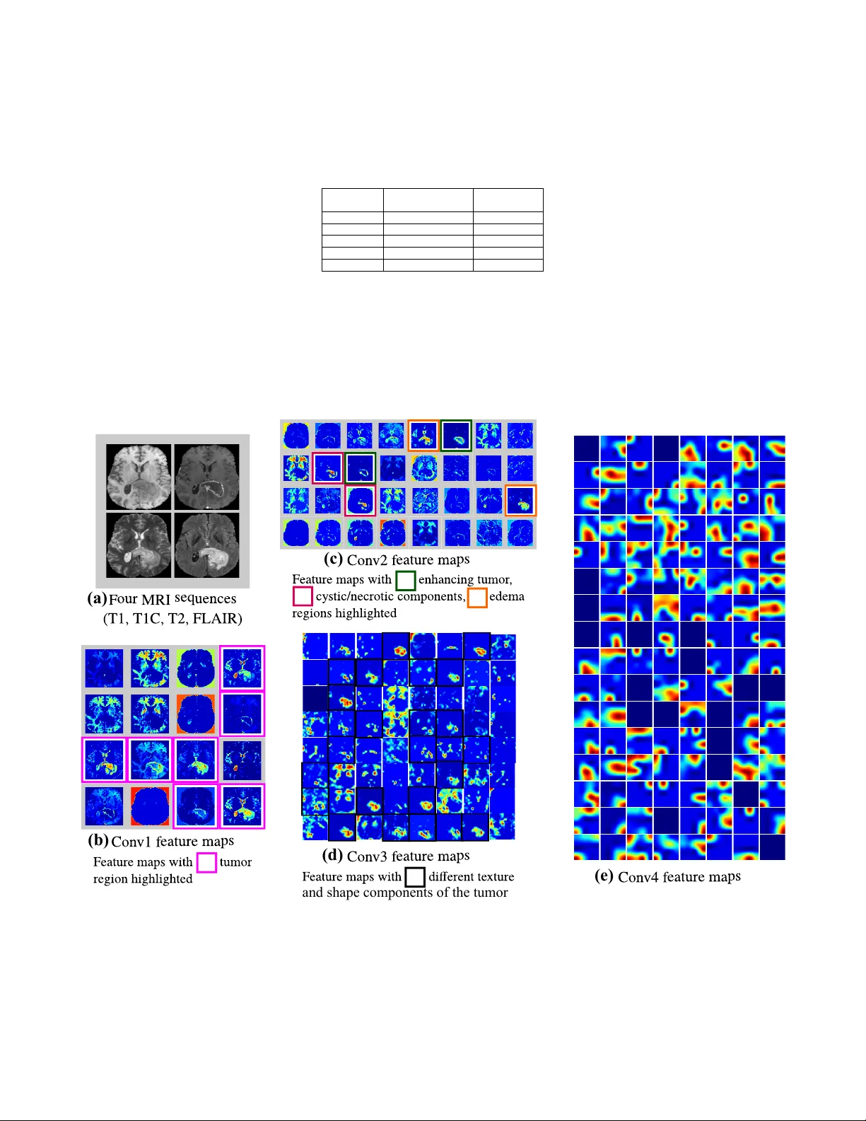 뇌종양 등급 및 1p/19q 코델리션 예측을 위한 멀티시퀀스 MRI 딥 라디오믹스