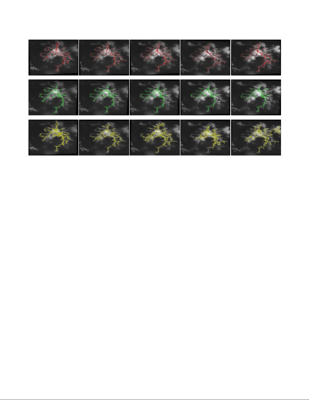 계층적 글리아 그래프 골격화와 매칭