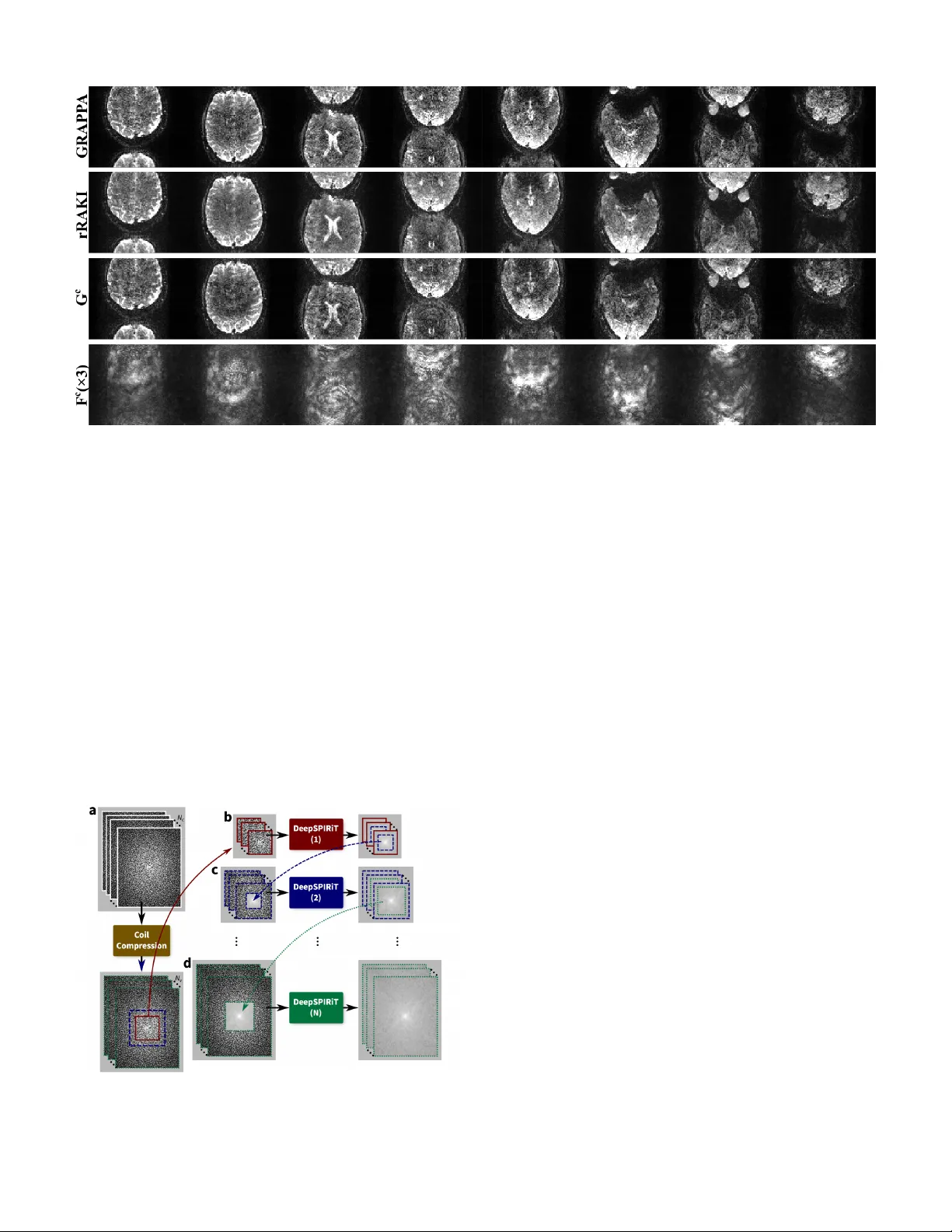 병렬 MRI 재구성을 위한 딥러닝 기법 개관