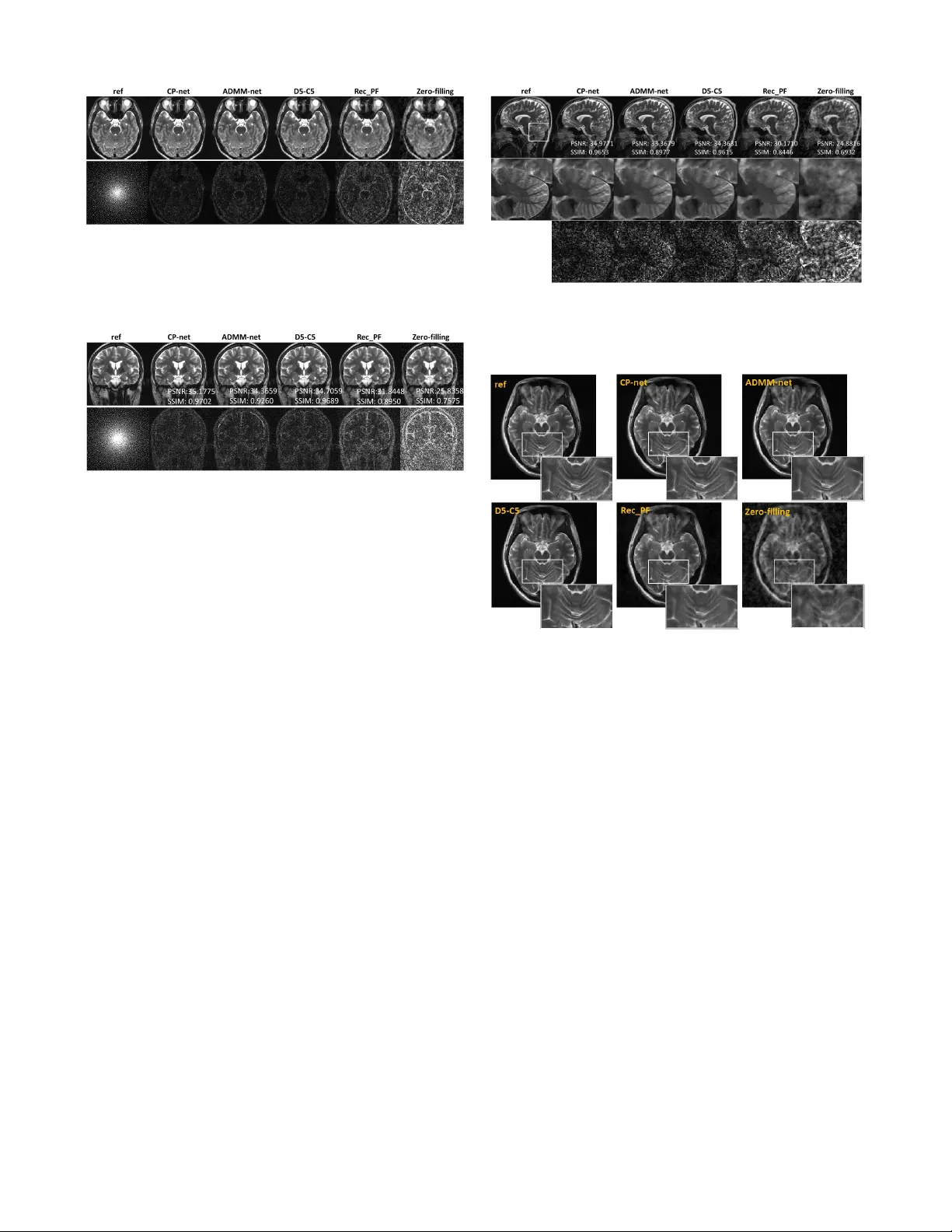 Accelerating MR Imaging via Deep Chambolle-Pock Network