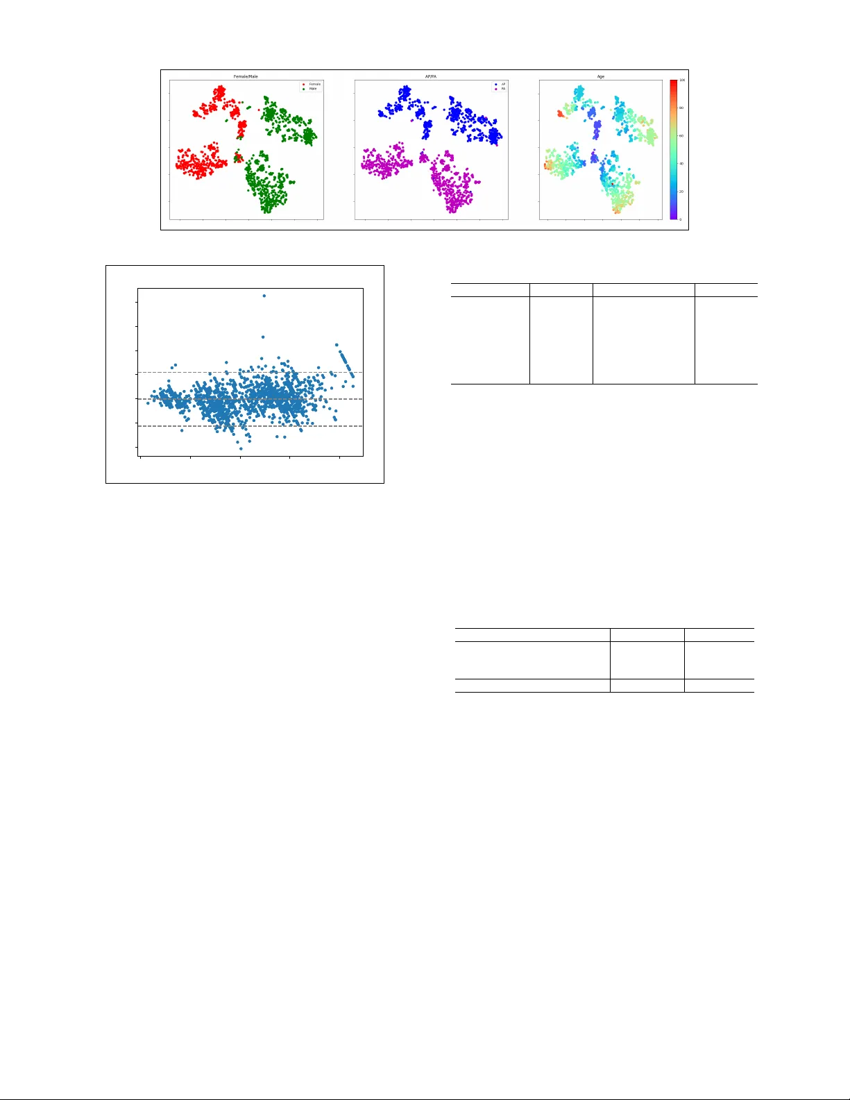 병원 규모 흉부 영상 데이터로 학습한 특징이 결핵 검출에 미치는 효과