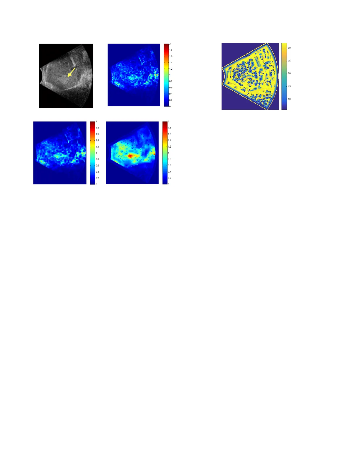 다중스케일 나카가미 파라메트릭 영상으로 간암 위치 정확도 향상