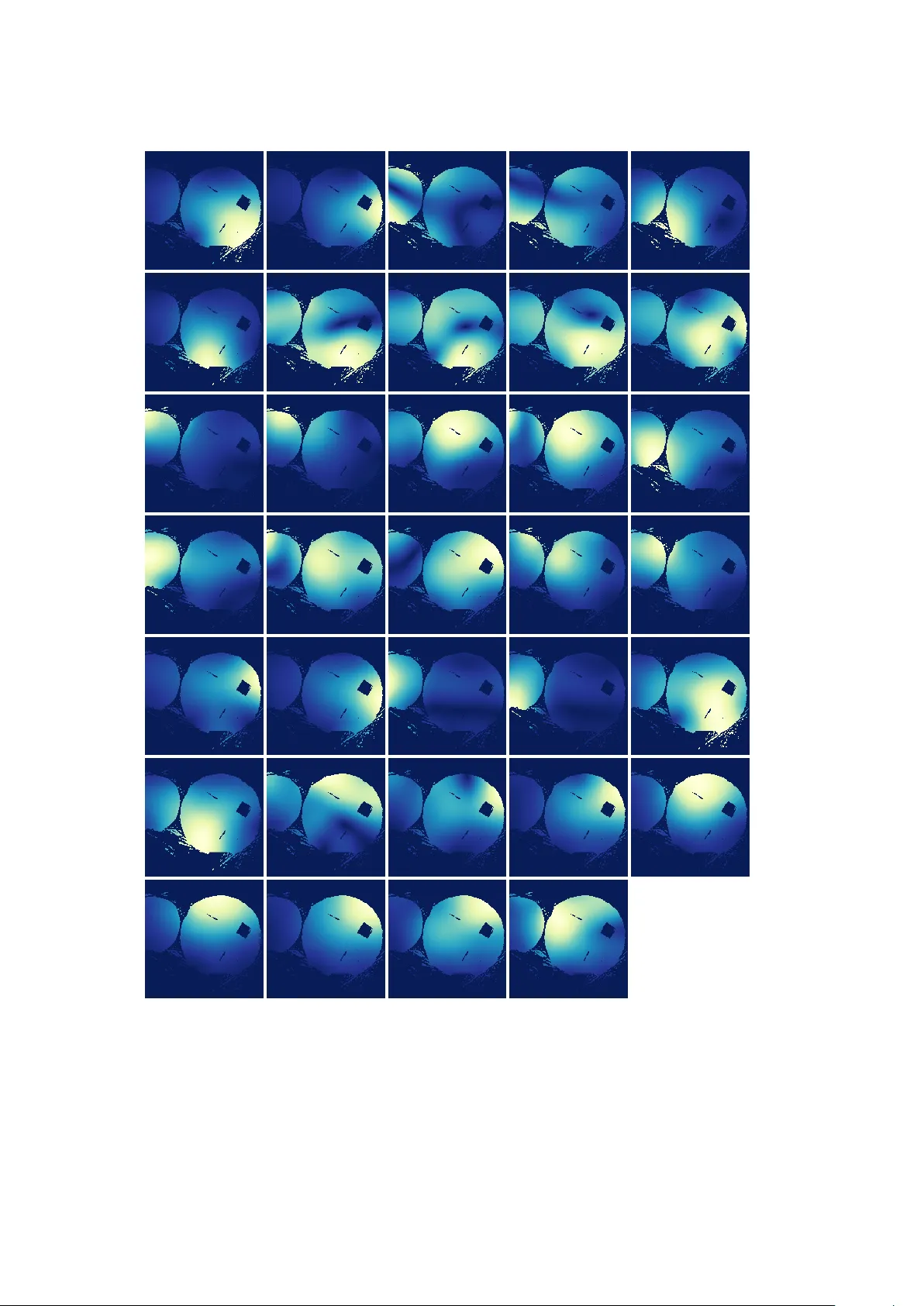 실시간 MRI 데이터 재구성을 위한 사전 데이터 분석