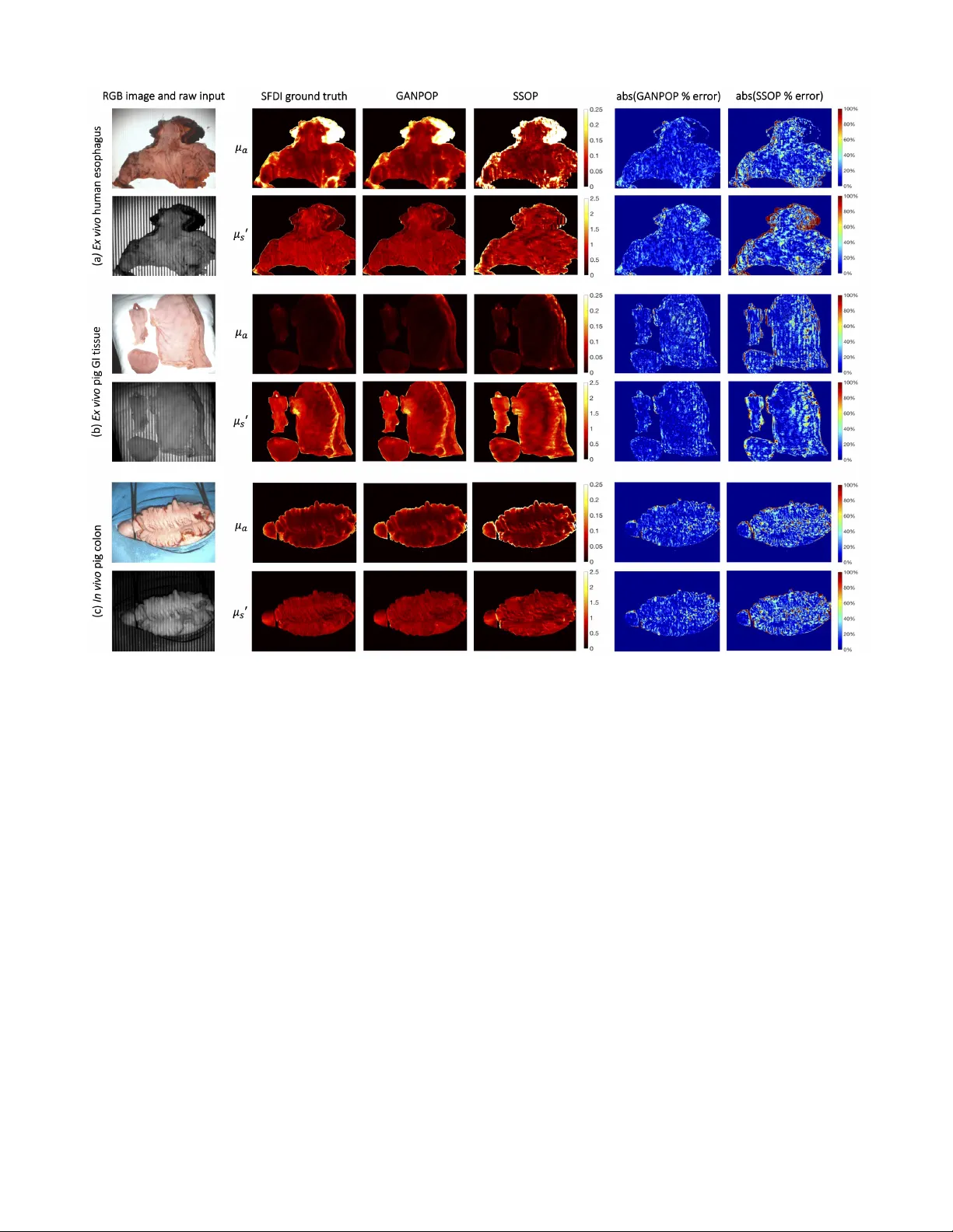 GANPOP: 한 장 이미지로 조직 광학 특성 고속 예측