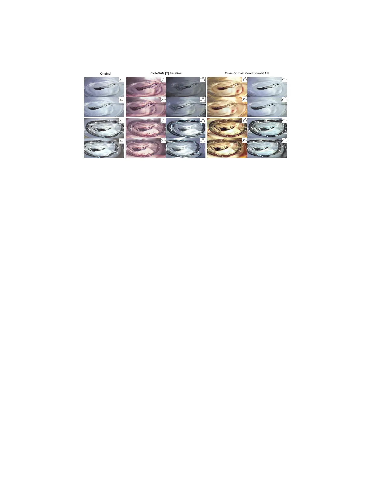 스테레오 수술 훈련을 위한 교차 도메인 조건부 GAN 기반 하이퍼리얼리즘