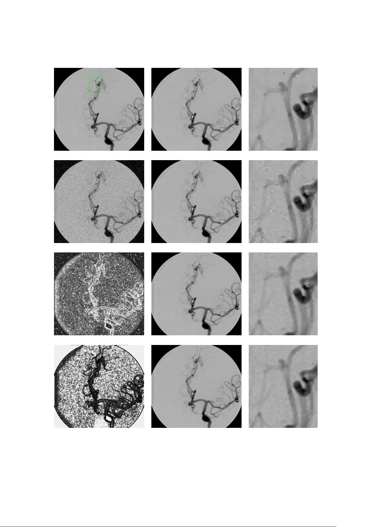 공간 가변 일반화 가우시안 정규화 기반 이미지 복원