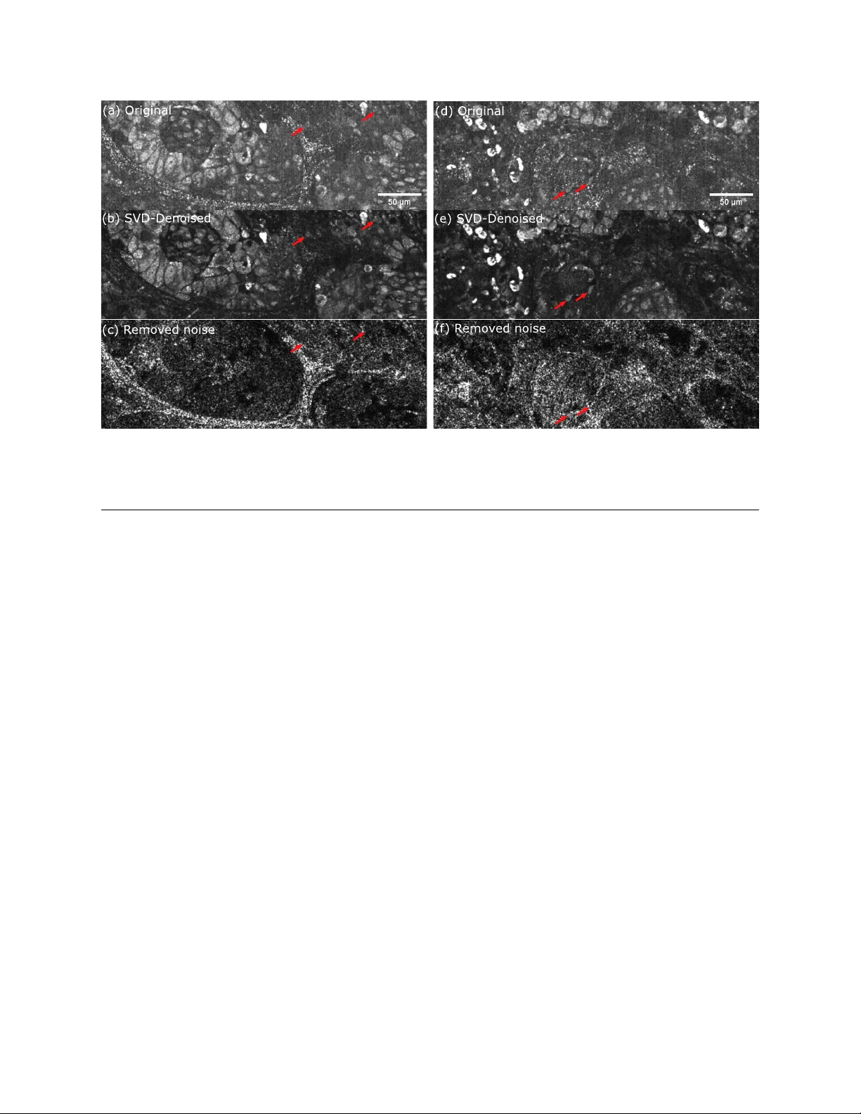 동적 전장 OCT의 움직임 아티팩트 제거와 신호 강화 기술
