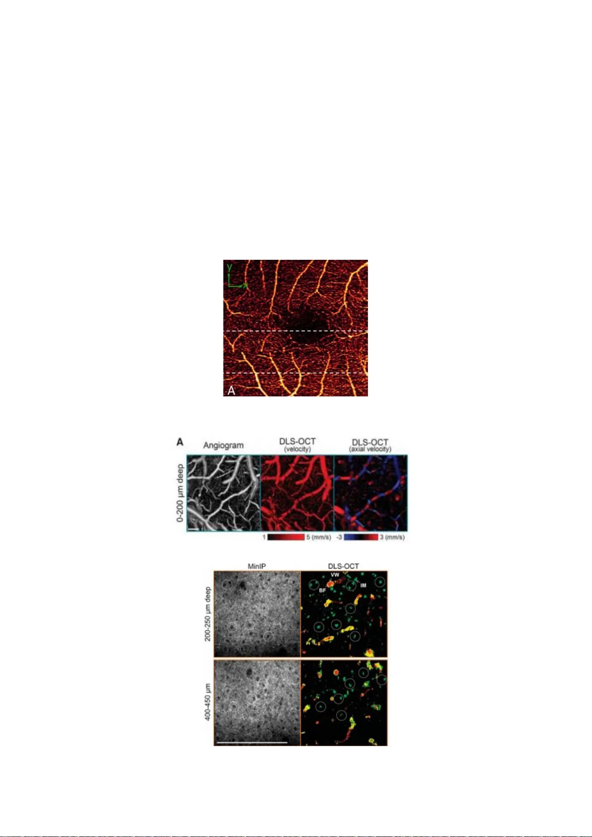미세혈관 혈류 영상 최신 동향 리뷰