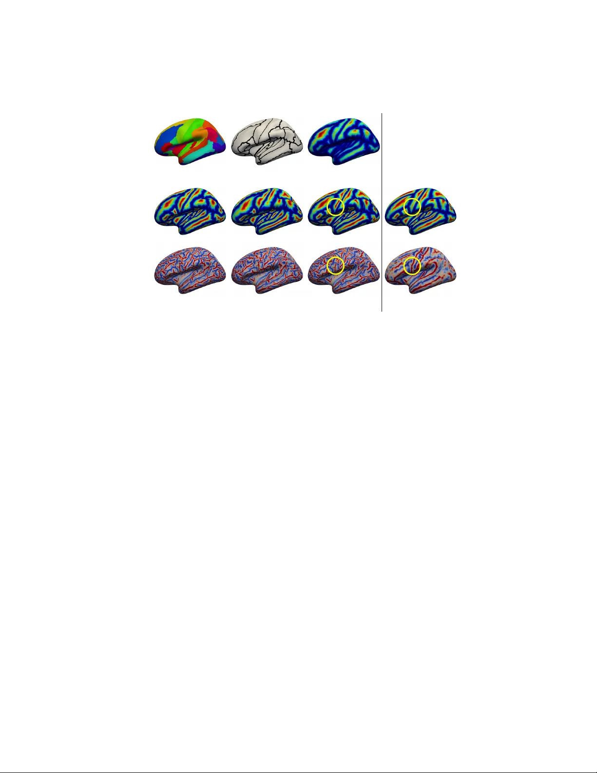 Cortical Surface Parcellation using Spherical Convolutional Neural   Networks