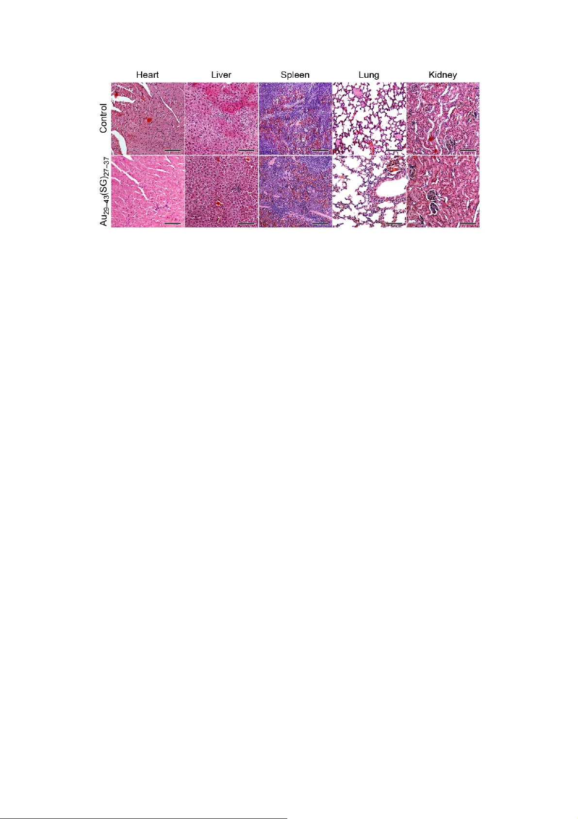 Ultrasmall Glutathione-Protected Gold Nanoclusters as Next Generation   Radiotherapy Sensitizers with High Tumor Uptake and High Renal Clearance