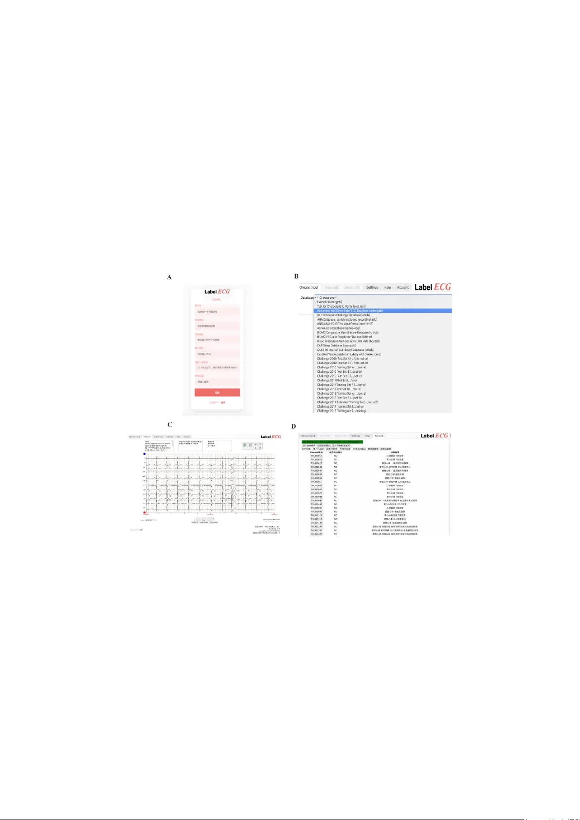분산 ECG 라벨링을 위한 웹 기반 도구 LabelECG
