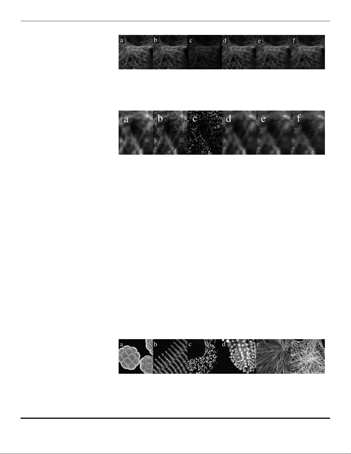 Image Reconstruction from Undersampled Confocal Microscopy Data using   Multiresolution Based Maximum Entropy Regularization