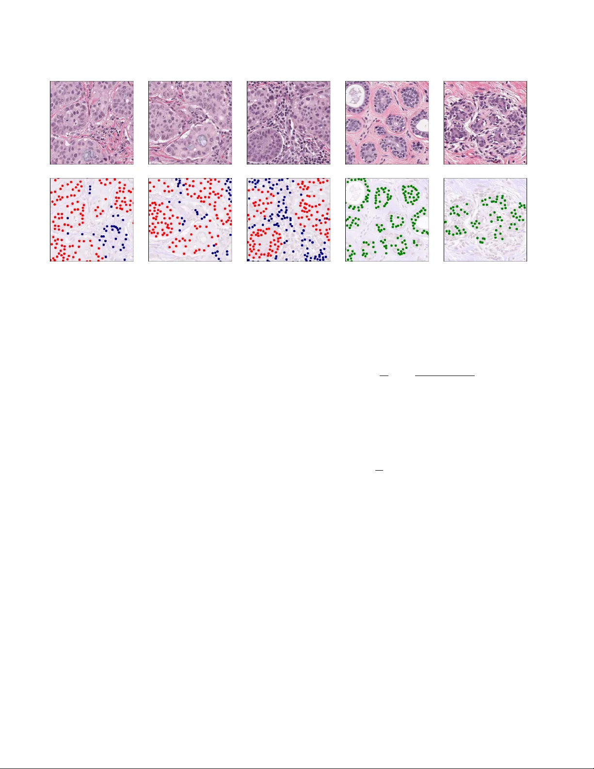 Breast Tumor Cellularity Assessment using Deep Neural Networks