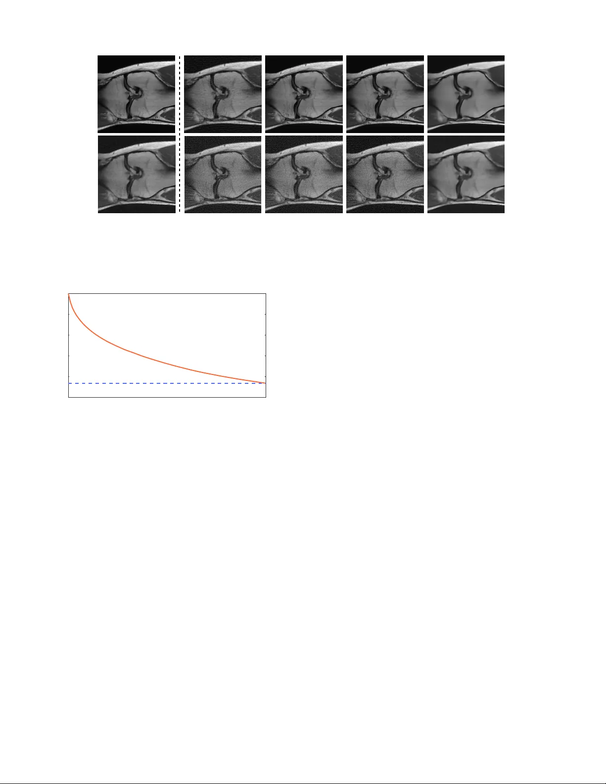 블록 좌표 정규화와 디노이징