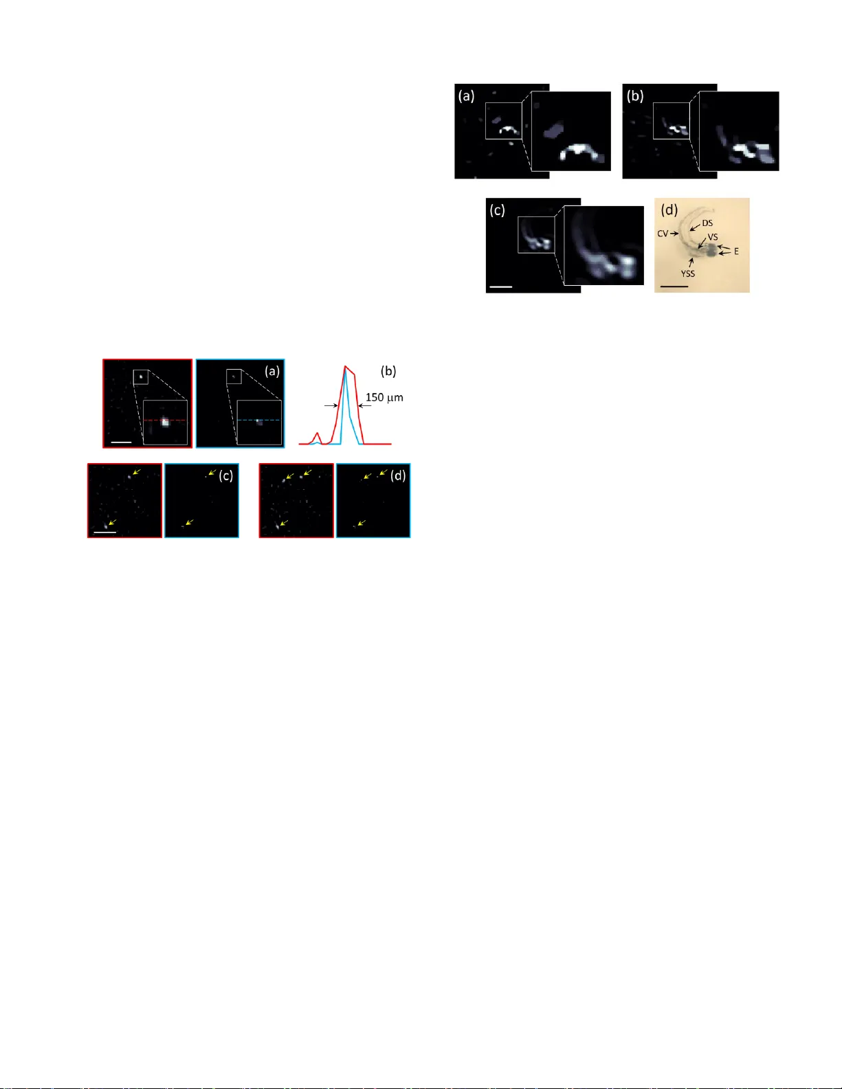 산란을 이용한 단일 검출기 광음향 단층촬영