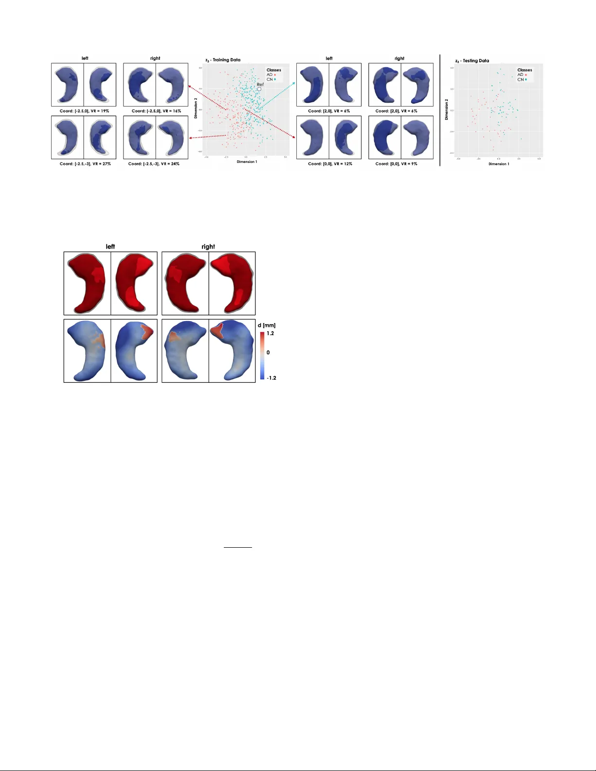 설명 가능한 해부학적 형태 분석을 위한 깊은 계층 생성 모델