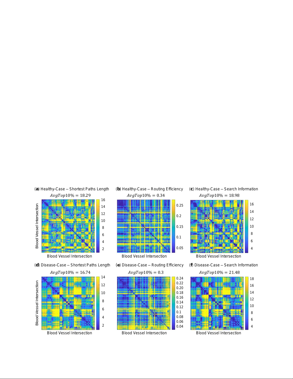 관상동맥 영상의 복잡망 모델링과 분석